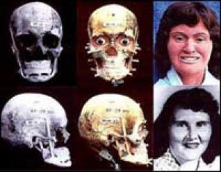 Forensic Science Facial Reconstruction 19